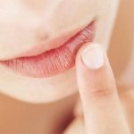 White dots and spots on the lips under the skin, in the corners: causes of rashes and specks on the lips