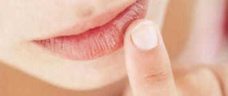 Белые точки и пятна на губах под кожей, в уголках: причины высыпаний и крапинок на губах