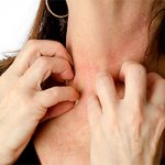 Девушка страдающая дерматитом чешет раздраженную шею
