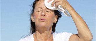 Hyperhidrosis is excessive sweating