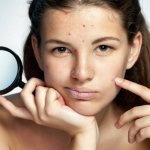 How to quickly get rid of subcutaneous acne on the face