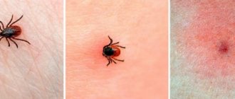 What does a tick bite look like? Photo