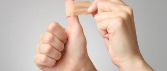 After applying ointments to your finger, you need to apply a bandage.