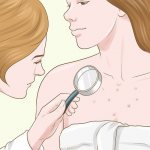 Chest rash may be due to allergies