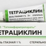 Tetracycline ointment for acne