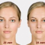 Значение морщин на лице. Расшифровка с картинками